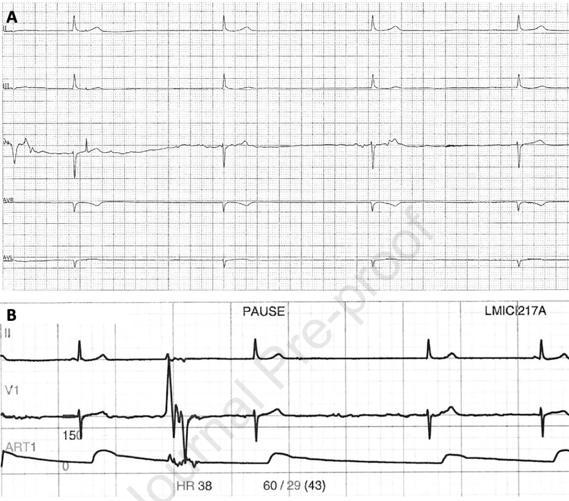 Heart Rhythm Case Reports tweet media
