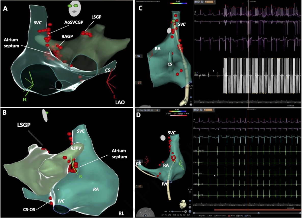 Heart Rhythm Case Reports tweet media