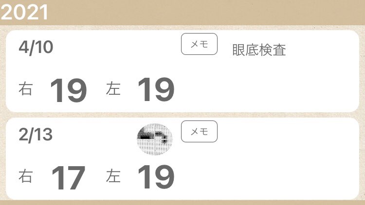 高眼圧症 高眼圧症