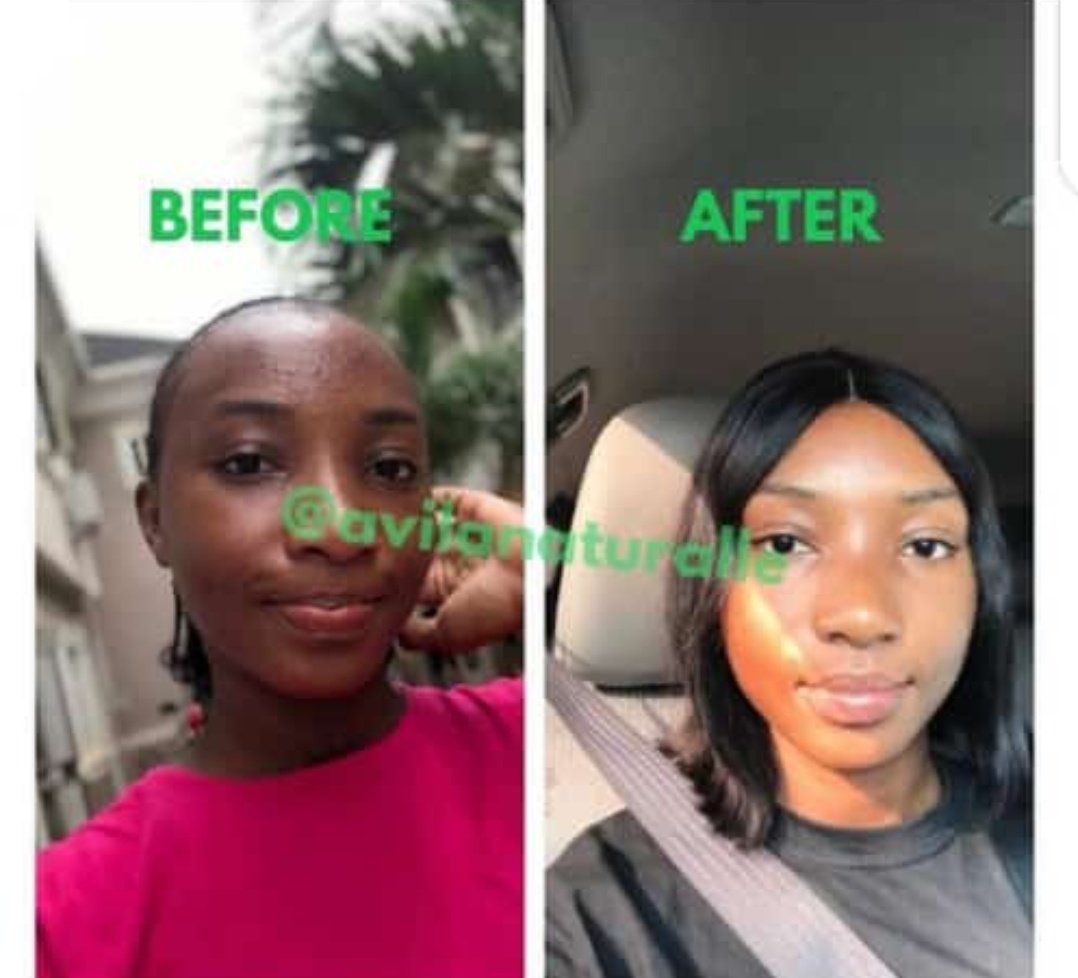 BDEssential's tweet photo. How is your weekend going?
Dont forget to patronize us..
Organic hair &amp; skincare products
We are 💯 percent natural
No chemicals or metals
We care you glow..

For more enquiries or to order
Send a DM now
WhatsApp or call 08092571650 https://t.co/HlBolN1XqL