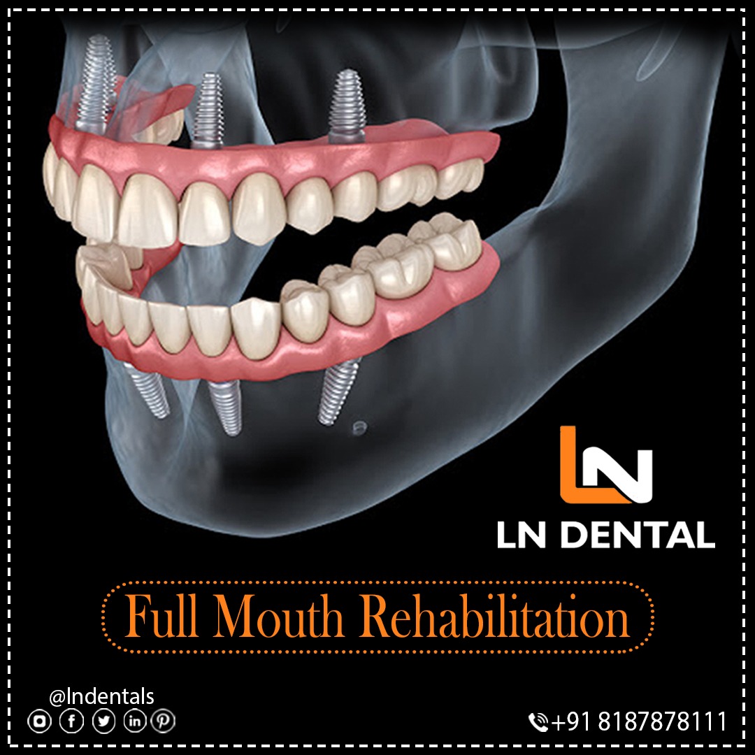 LN Dentals (@lndentals) / Posts / X