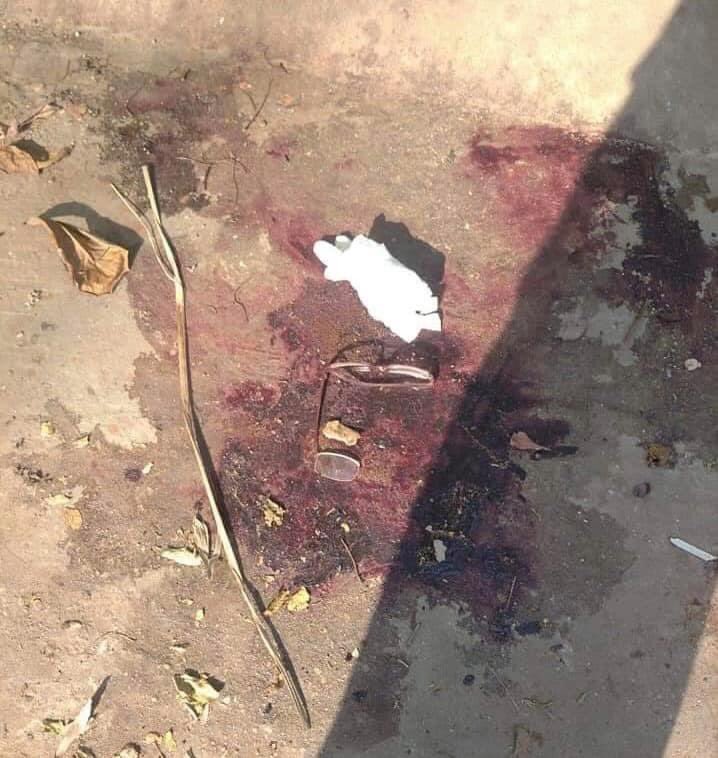 BAGO is under shot by Military Junta. Civilians are running out of their home. Over 100 civilians have been killed by military junta within 2 days. <a href="/RapporteurUn/">UN Special Rapporteur Tom Andrews</a> <a href="/KenRoth/">Kenneth Roth</a>
<a href="/UN/">United Nations</a> <a href="/cnnbrk/">CNN Breaking News</a> <a href="/BBCWorld/">BBC News (World)</a>
#WhatsHappeningInMyanmar #Apr10Coup