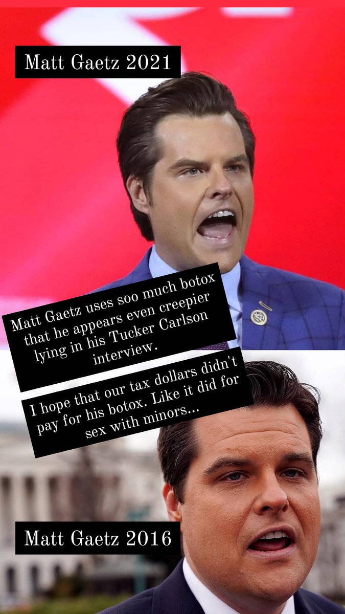 OGjaybabydawg's tweet photo. Did our tax dollars pay for his botox too? #mattgaetzissodumb he makes #laurenboebert look smart. #mattgaetz #botoxking #gaetzgate #laurenbobertissodumb https://t.co/NXPZu6Ll6a