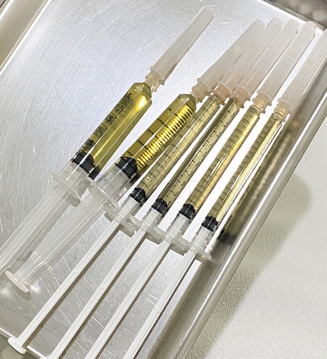 detailsoftoday's tweet image. ทำ PRP มา ครบ15วัน เดี๋ยวมารีวิวเลย คือมันโครตดี โครตปัง ดีกว่าฉีดมาเด้หลายเท่า แล้วมันเป็นเลือดเราเองไง ไม่แพ้ที่เปลี่ยนมาฉีดprp เพราะเคยแพ้มาเด้ที่นึง เจอprp ไปทั้งใต้ตา ทั้งผิวหน้า ปริ่ม เดี๋ยวขอรวบรวมมาทำรีวิว