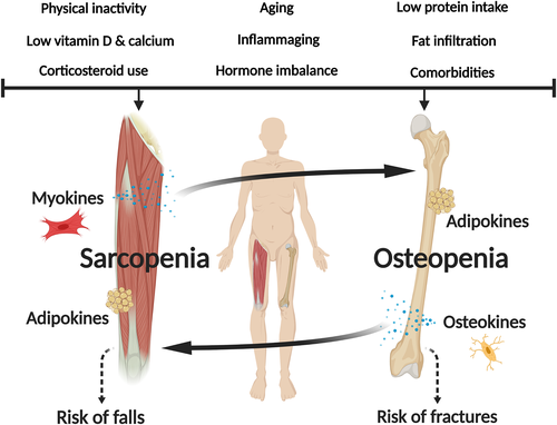 JCSM_cachexia's tweet photo. In one of the most accessed JCSM articles of 2020, @DrBenKirk, Jesse Zanker and @DrGustavoDuque discuss the importance of screening, assessing, and treating osteosarcopenia to keep our aging population healthy.
https://t.co/Ln8TdQA5xd https://t.co/jkJqX97Kgc