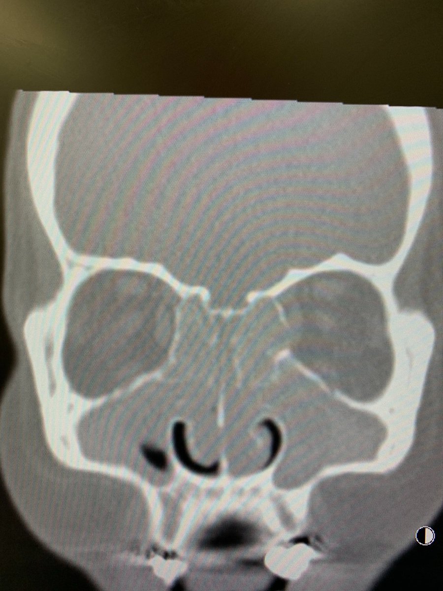 Dr Harsha Kariyawasam PhD FRCP tweet media