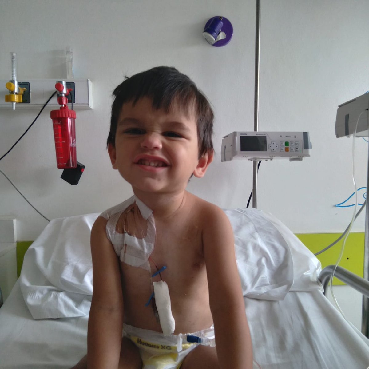 Eldasaintpierr1's tweet image. Hola no somos de publicar nada de lo que pasa con Fidel, pero necesitamos con suma urgencia CATÉTER COOK 5FR SIMPLE O DOBLE LUMEN(foto similar), ya que el se alimenta con alimentación parenteral desde que nació y para poder hacerlo necesitamos de ese catéter.