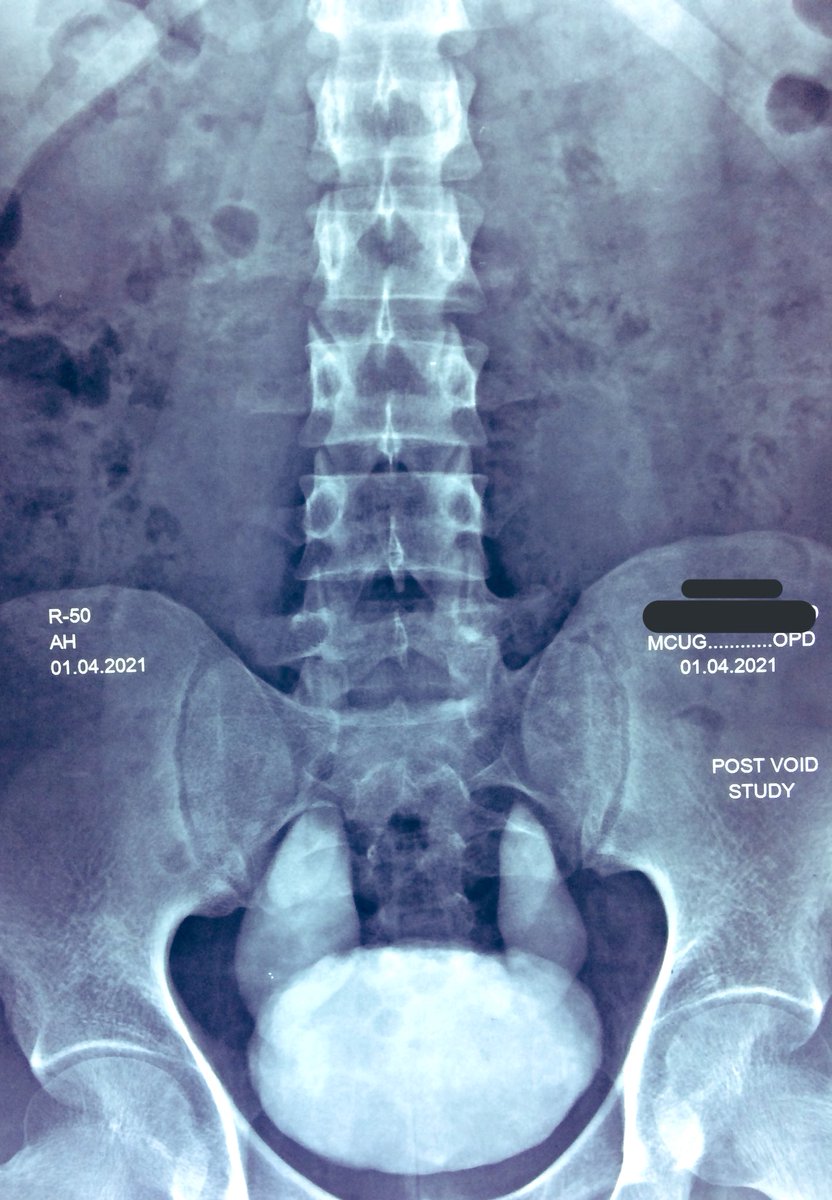 theAWMahmood's tweet photo. If you know, you know! 😎 #UroSoMe #urology #aua #mcug #reimplant #surgery #MedTwitter #MedStudentTwitter #healthcare https://t.co/EJJLXoPSjo