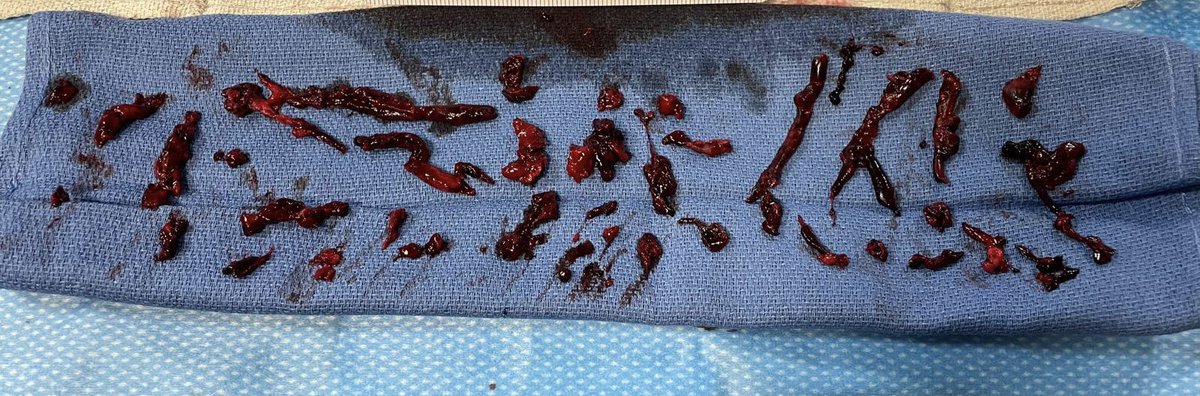 Robert A Lookstein MD, MHCDL tweet media