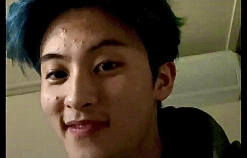 yeoltaoxi's tweet photo. For those who targeting mark because of his pimples, let me tell you this "that's normal for a young man and take note they are also stressed, as if you haven't experienced pimples. HIS IMPERFECTION MAKES HIM PERFECT!!" THAT'S IT. https://t.co/zf5omvQVmo