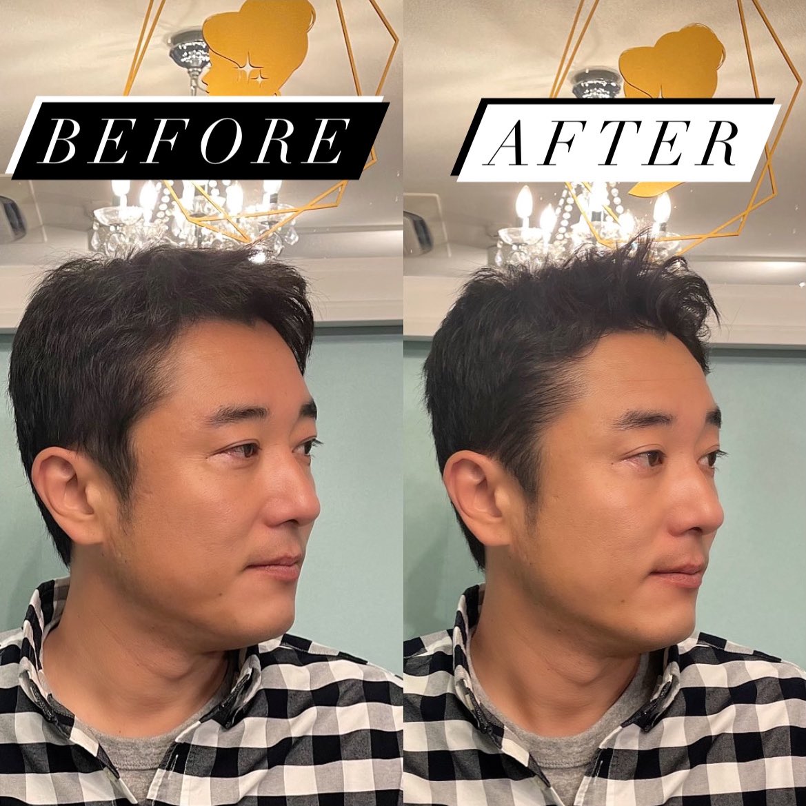 小顔リフトアップ ルミエール メンズのハイフ 美容のプロが選ぶshe Lineで安全に効果を実感 Sheline シーライン Hifu ハイフ ダブロ ウルセラ メンズ美容 メンズハイフ メンズたるみケア メンズリフトアップ メンズ小顔エステ 小顔に 小顔リフトアップ ルミエール メンズのハイフ 美容のプロが選ぶshe Lineで安全に効果を実感 Sheline シーライン Hifu ハイフ ダブロ ウルセラ メンズ美容 メンズハイフ メンズたるみケア メンズリフトアップ メンズ小顔エステ 小顔に
