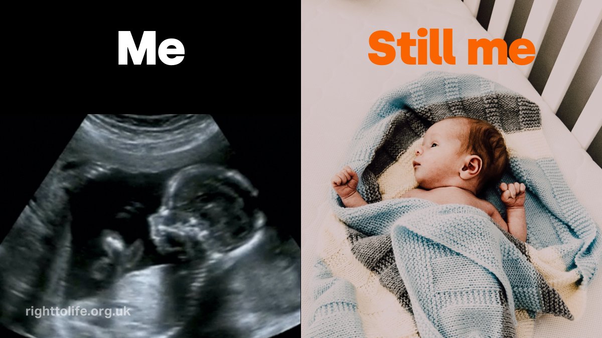 RightToLifeUK's tweet photo. I might be at a different stage of life but I’m still the same person. https://t.co/tJX9nWjHe1