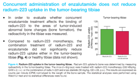guconnectinfo's tweet photo. Poster 1392 at #AACR21 looks at anti-tumor activity of combined radium-223 & enzalutamide in an LNCaP #prostatecaner xenograft model. Data from PSA levels suggests synergistic anti-tumor efficacy, & enzalutamide did not reduce radium-223 uptake in the tumor-bearing tibiae. #MedEd https://t.co/yPJyv48YuS