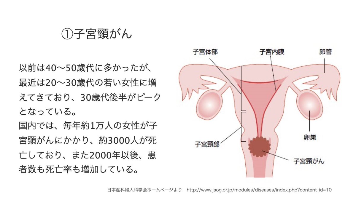takashi_m86's tweet photo. 4/17 12:30よりClubhouse『🌹男性も知って🙋🏻‍♂️🙋🏻‍♂️女性の体👩🏻‍⚕️何でも相談室🙋🏻‍♀️』で子宮頸がん手術について解説します。
日本産科婦人科学会・国立がん研究センターのウェブサイトを参考にしています。 https://t.co/RFHg5wbFSn