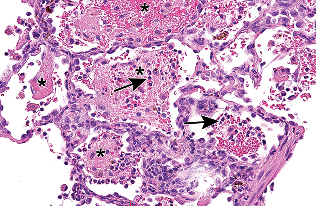 KeaneToxPath's tweet photo. Toxicologic Pathology by @SAGELifeScience has a new podcast: Case Studies in Inhaled Biologics  Dr. Peter Hall will explain conducting nonclinical toxicity studies with this important class of drugs, now more important than ever with COVID-19. Listen at https://t.co/5LhhWFH0gB https://t.co/Sy27bDR8OH