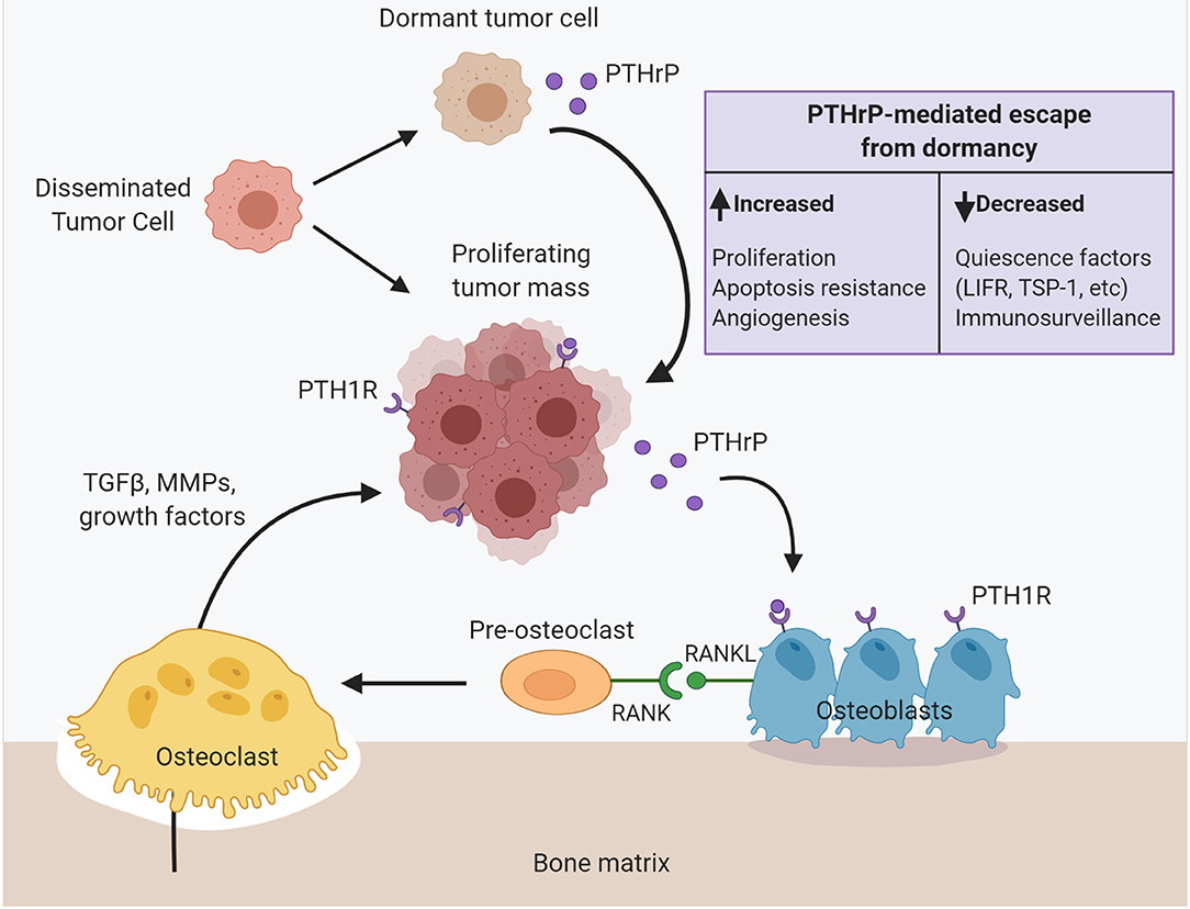 VanderbiltMSTP's tweet photo. Check out the new review in @FrontOncology by Courtney Edwards (G3)! In it, she covers the biology of #PTHrP in #cancer progression: this secreted factor can slow down early tumor growth but adds fuel to the fire in later-stage disease. Read here: https://t.co/FcW3puN1kQ https://t.co/awAUSl8Nd6