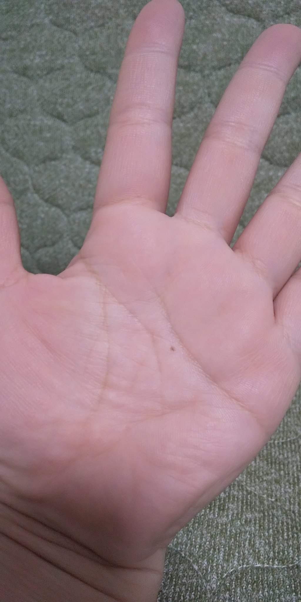 鶲 疫病退散祈願 しょこたんの手のひらに突然黒子が ってネットニュース見て思い出したんだけど 私の手のひら にも先日気づいたら黒子が出来てたんだよ しかも両手 手のひら ほくろ で調べると癌とか怖いこと書いてあって 医者行った方がいい