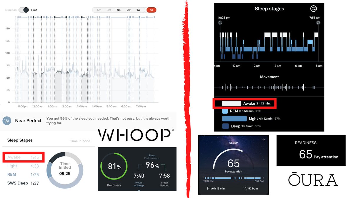 The same night of sleep measured by Whoop and Oura.

Subjectively, it was awful, I was awake from ~3-6am.

Whoop = 96% sleep score, I was "near perfect"!

Oura = 65 and clocked nearly double the amount of awake time vs Whoop.