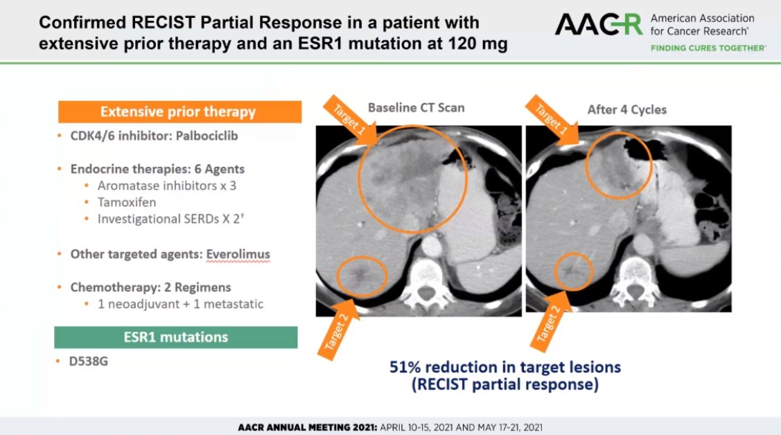 HartungIngo's tweet photo. And it turns out to be a 1-2 punch for CRBN vs. VHL at #AACR21. Also ER-degrading #PROTAC #ARV471 is employing a cereblon binder to achieve efficient ER degradation in humans & shows promise for breast cancer patients. Sorry @alessiociulli, you lost your bet. @ArvinasInc @AACR https://t.co/jtL1yKCMYE