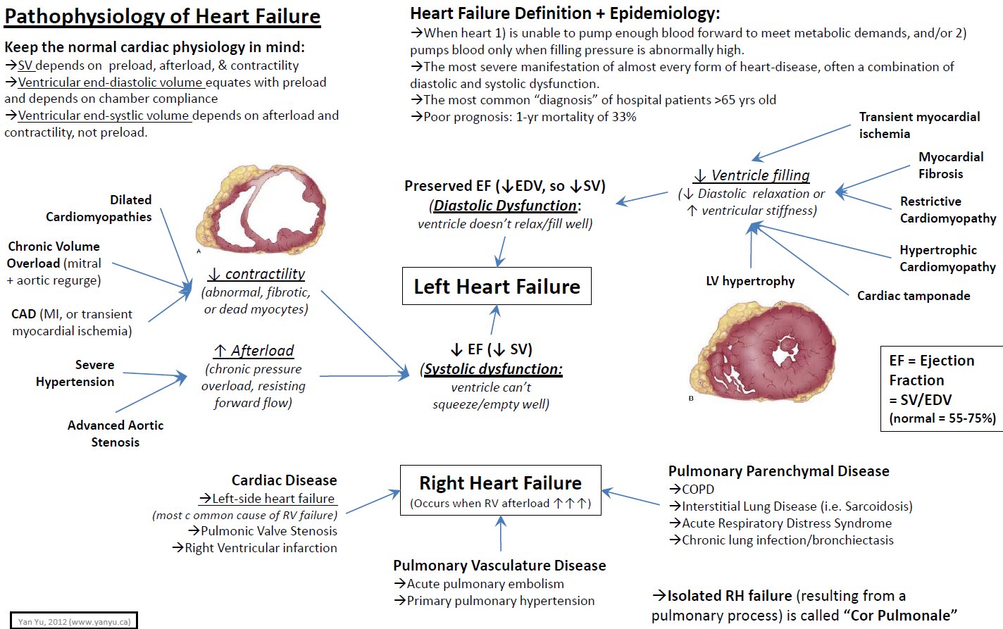 Manual Of Medicine On Twitter Pathophysiology Heart Failure Meded Foamed Medtwitter