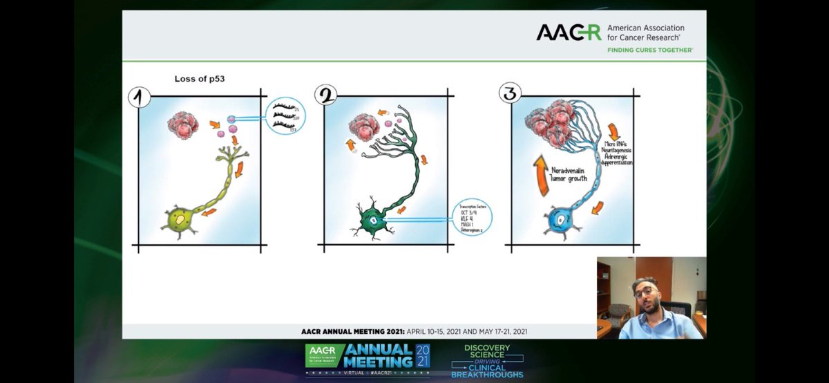 Aiims1742's tweet photo. #AACR21 NextGen Stars Spotlight featuring Moran Amit (@MoranAmit1) @MDAndersonNews and his research on neuron reprogramming in p53 mutant cancers. ICYMI his @nature paper on this topic:
https://t.co/FfzSJyQgfq https://t.co/pcv3XmN0DV