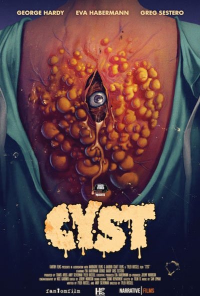 Cisto (<a href="/CYSTMovie/">CYST</a>), de Tyler Russell, é um filme sobre um cisto cheio de pus assassino. Não tem muito mais o que dizer. Body horror com cara de narrativa de ficção científica da década de 1950 de primeira categoria. De graça, na programação do <a href="/fantaspoa/">Fantaspoa</a>.