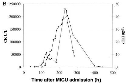 3/Subsequent case descriptions found that patients who developed PRIS also had:Severe rhabdomyolysis and diffuse skeletal and cardiac muscular necrosisHypertriglyceridemiaLactic acidosis Multiorgan failureKids seem to be more susceptible.  https://pubmed.ncbi.nlm.nih.gov/10759487/ 