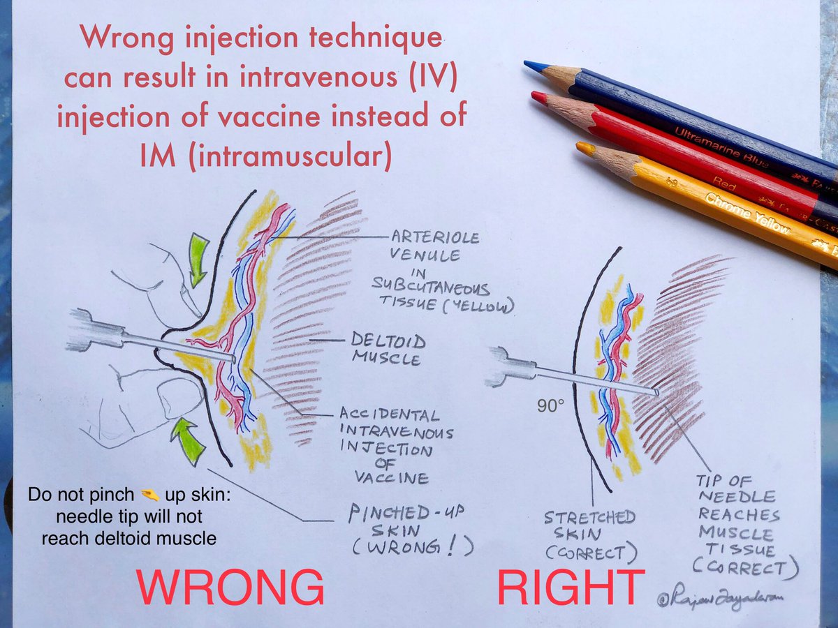 Inadvertent intravenous injection is possible if people continue to give IM injections blindly and using the wrong technique. (See attached picture from Reuters that was meant to showcase vaccination process) The dose injected for COVID-19 is 5,00000,00000 adeno viruses. 12/n  https://twitter.com/rajeevjay...