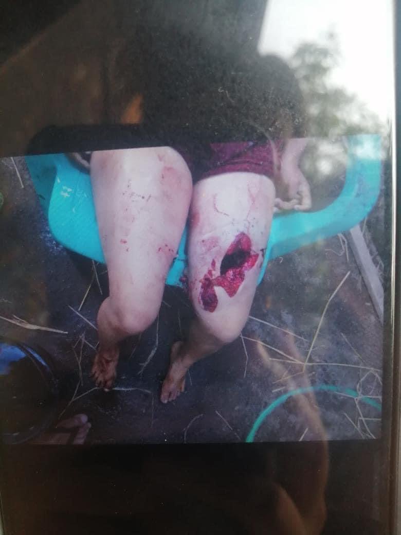 Waiyan699's tweet photo. tw // blood 
Junta Terrorists fired HEAVY ARTILLERY in Myothit near Bamaw Tsp, #Kachin State destroying civilians’ houses and WOUNDING some in the early morning of April 12. There’re still fighter jets flying over there. 

#WhatsHappeningInMyanmar 
#Apr12Coup 
#OpCCP https://t.co/9X3qaV13YQ