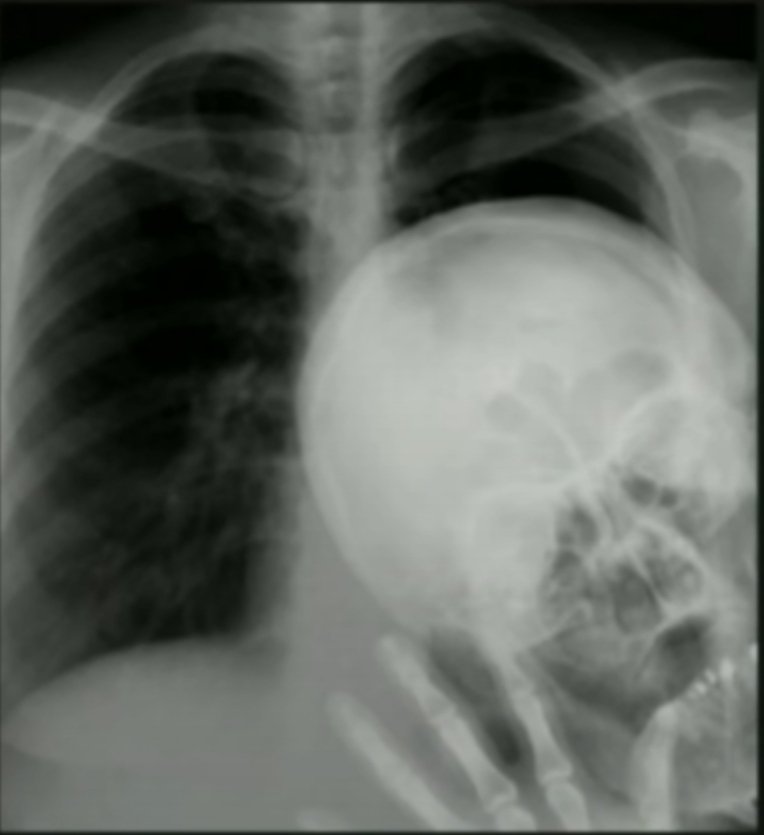 ¿Vosotros también teneis un amigo gilipollas que se empeña en salir en todas las fotos?