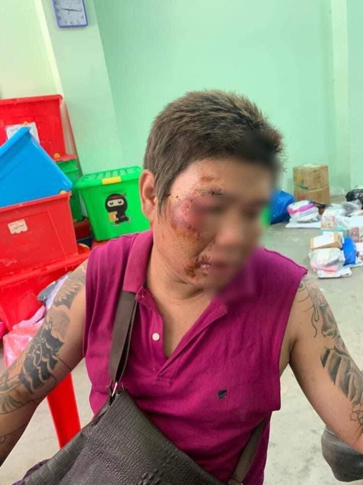 simon_lynn11's tweet photo. Tw // Sensitive Content : A delivery man was abused and tortured by Junta for wearing black medical masks. 

It was okay when Junta wore black robber masks themselves but why do they have to beat a human into a pulp ? 

Junta robbed his bike @hrw @UN_HRC #WhatsHappeningInMyanmar https://t.co/6XFPw9imcZ
