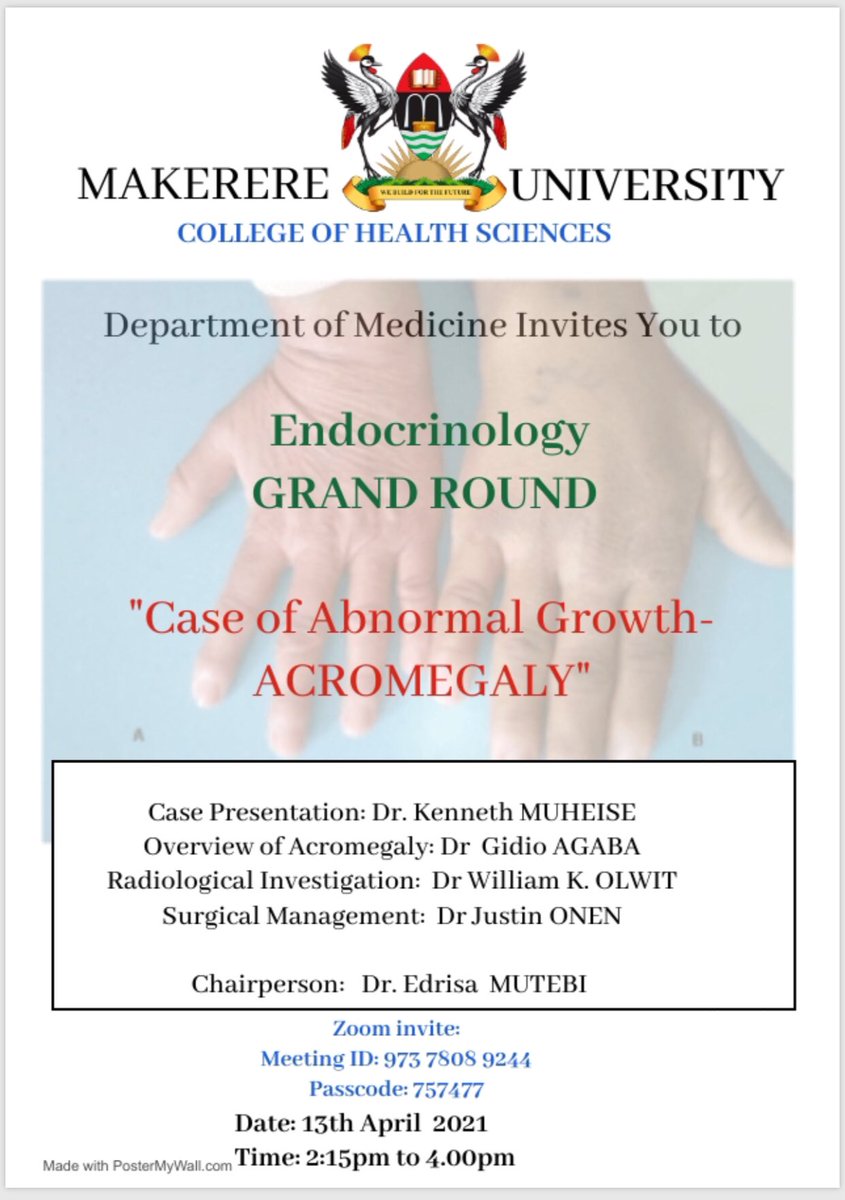 The Grand Round is on this Tuesday led by Division of Endocrinology, Dept of Medicine @MakerereCHS and @kirudduNRH . Join in via zoom. Cc @MakCHS_SOM @MulagoHospital @MinofHealthUG @MakerereU