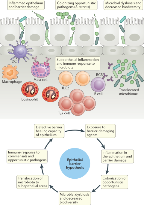 NatRevImmunol's tweet photo. Does the epithelial barrier hypothesis explain the increase in allergy, autoimmunity and other chronic conditions? https://t.co/FHSRgRK9tj https://t.co/31xQJ1uHhX