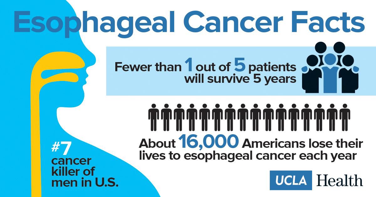 The stats don’t lie. April is #esophagealcancerawarenessmonth Speak you your doctor #GERD #BarretsEsophagus #UCLAEsoph Don’t wait until is too late!