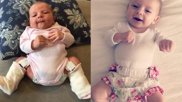 Be a smile of those who have no reason to smile. Show your mercy &amp; Love by donating some amount to children who are suffering from Hip Dysplasia: bapc.torc2.com

#makingpositivechange,#lowerlimbconditions #hipdysplasia #talipes #cerebralpalsy #lowerlimbamputations