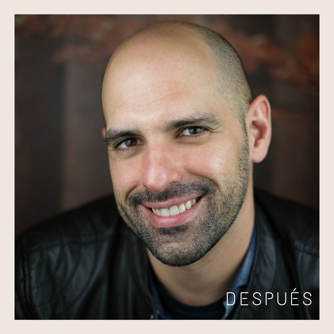 SMYLIFE_'s tweet photo. Una sonrisa puede cambiar completamente la imagen de una persona. 

Ejemplo de ello es Pedro José, que ha visto cómo su #sonrisa se transformaba gracias al tratamiento de #carillasdeporcelana. 

Si quieres un cambio radical, ven a Smylife y disfruta de una valoración gratuita. https://t.co/bjT3PC8Hq0