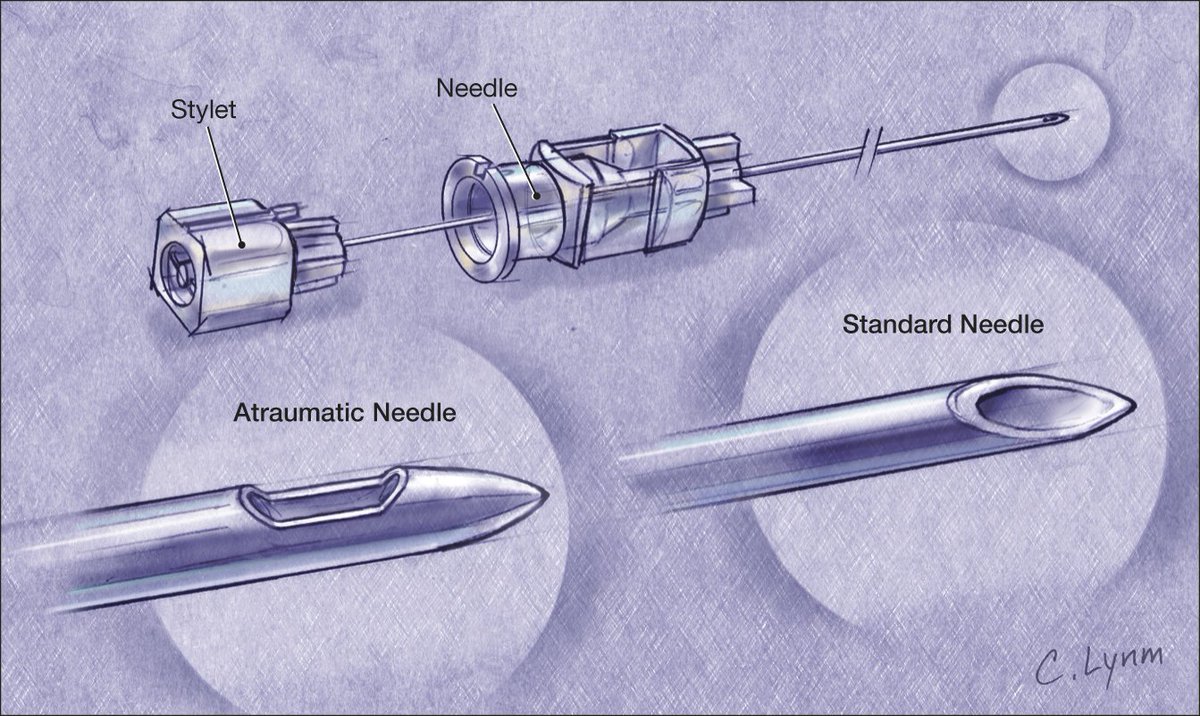 It's important to understand the anatomy of an LP needle/stylet. An LP needle is hollow with an inner stylet. Why the stylet? Why not just use a hollow needle to access the subarachnoid space?2/Img: JAMA