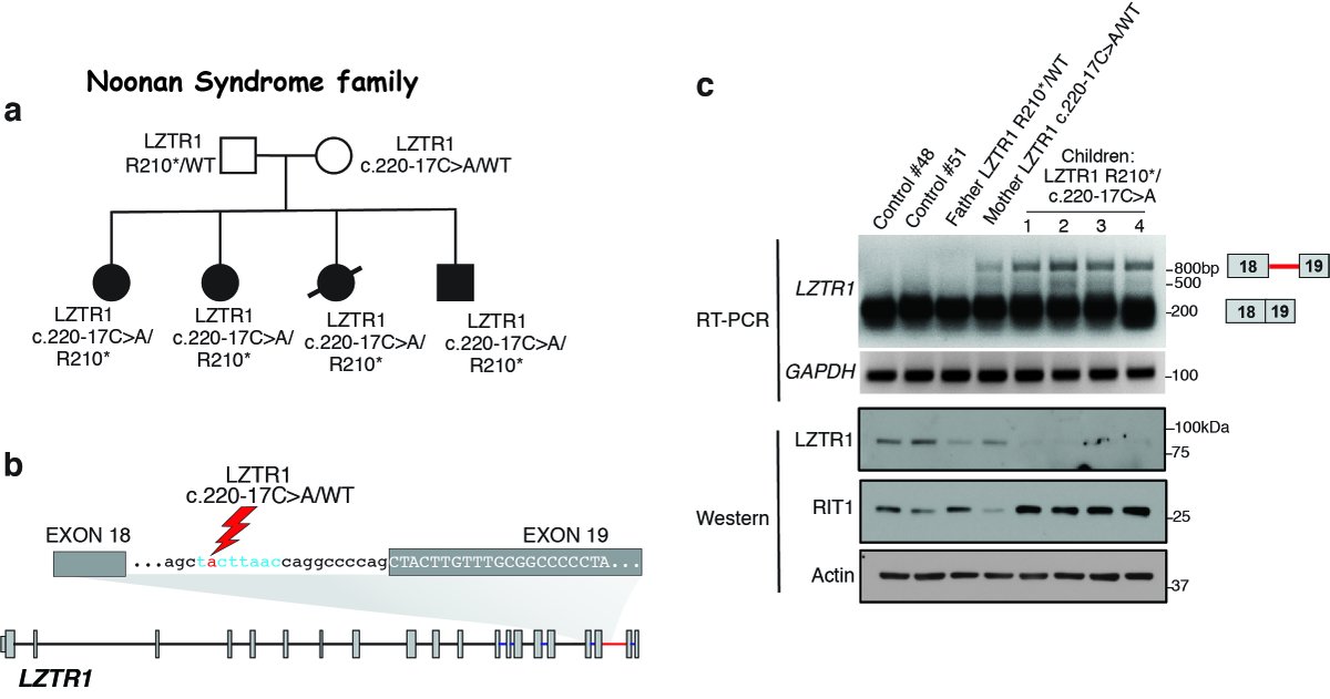 8.With wonderful help from  @castel_pau & the Frank McCormick lab ( @frankpmccormick) we found that mutations within LZTR1’s minor intron itself was transforming to hematopoietic cells and present in Noonan Syndrome ( @noonansyndrome,  @Noonan_Syndrome) as well as Schwannomatosis.