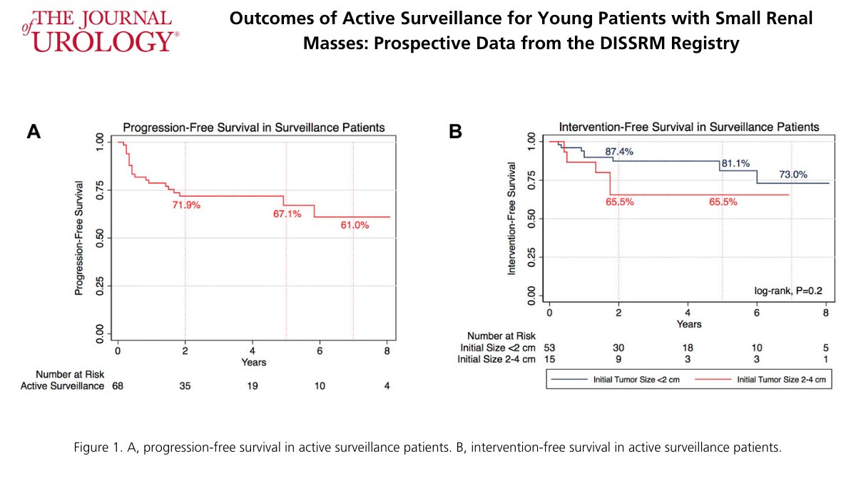 Journal of Urology (@jurology) on Twitter photo Featured Article from the May Issue:
Outcomes of Active Surveillance for Young Patients with Small Renal Masses: Prospective Data from the DISSRM Registry bit.ly/3a0AYvu Featured Article from the May Issue:
Outcomes of Active Surveillance for Young Patients with Small Renal Masses: Prospective Data from the DISSRM Registry bit.ly/3a0AYvu