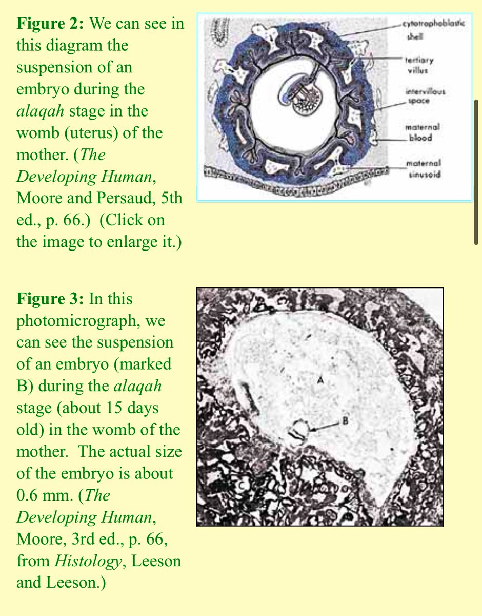 The second meaning of the word alaqah is “suspended thing.”  This is what we can see in figures 2 and 3, the suspension of the embryo, during the alaqah stage, in the womb of the mother.