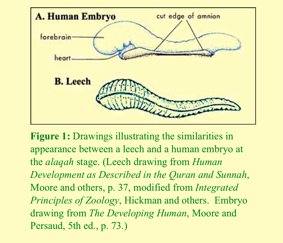Also, the embryo at this stage obtains nourishment from the blood of the mother, similar to the leech, which feeds on the blood of others. (3)