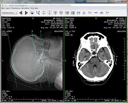 8/ In 2014, Nuance acquired Accelarad, the makers of SeeMyRadiology, a cloud service that processes medical images. Computer vision has made serious progress in radiology.