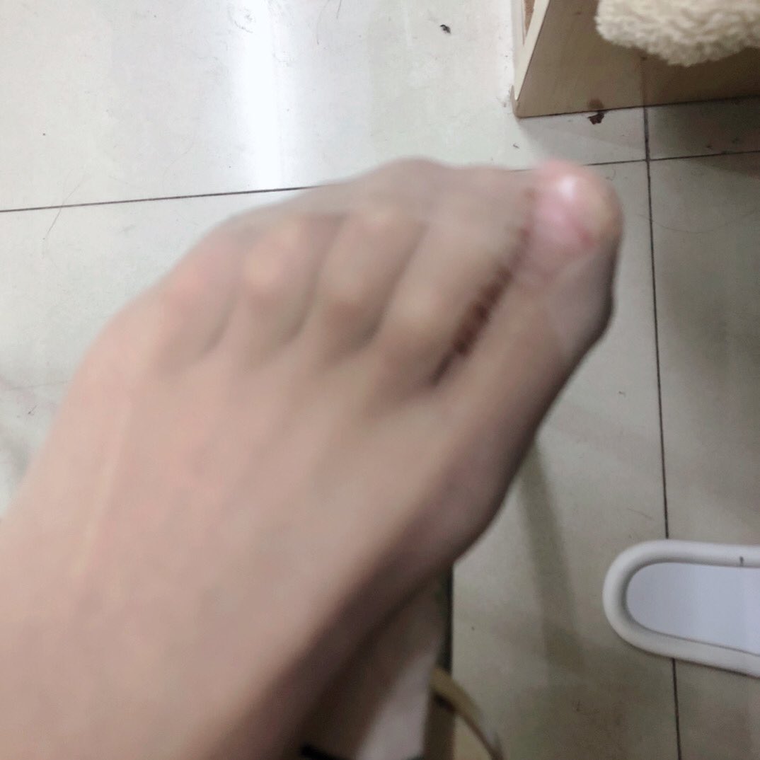 Chan60846108's tweet photo. 丝袜破了 
不想要了 
想要的滚过来私

#傻逼提款机 #报销奴 #账单奴 #工资奴 #绿帽奴 #ATM奴 #提款机奴 #贡奴 #上贡 #榨金 #精神控制 #洗脑 #羞辱 #压榨 #男m #绿帽 #踩踏 https://t.co/kAHO7iBYZF