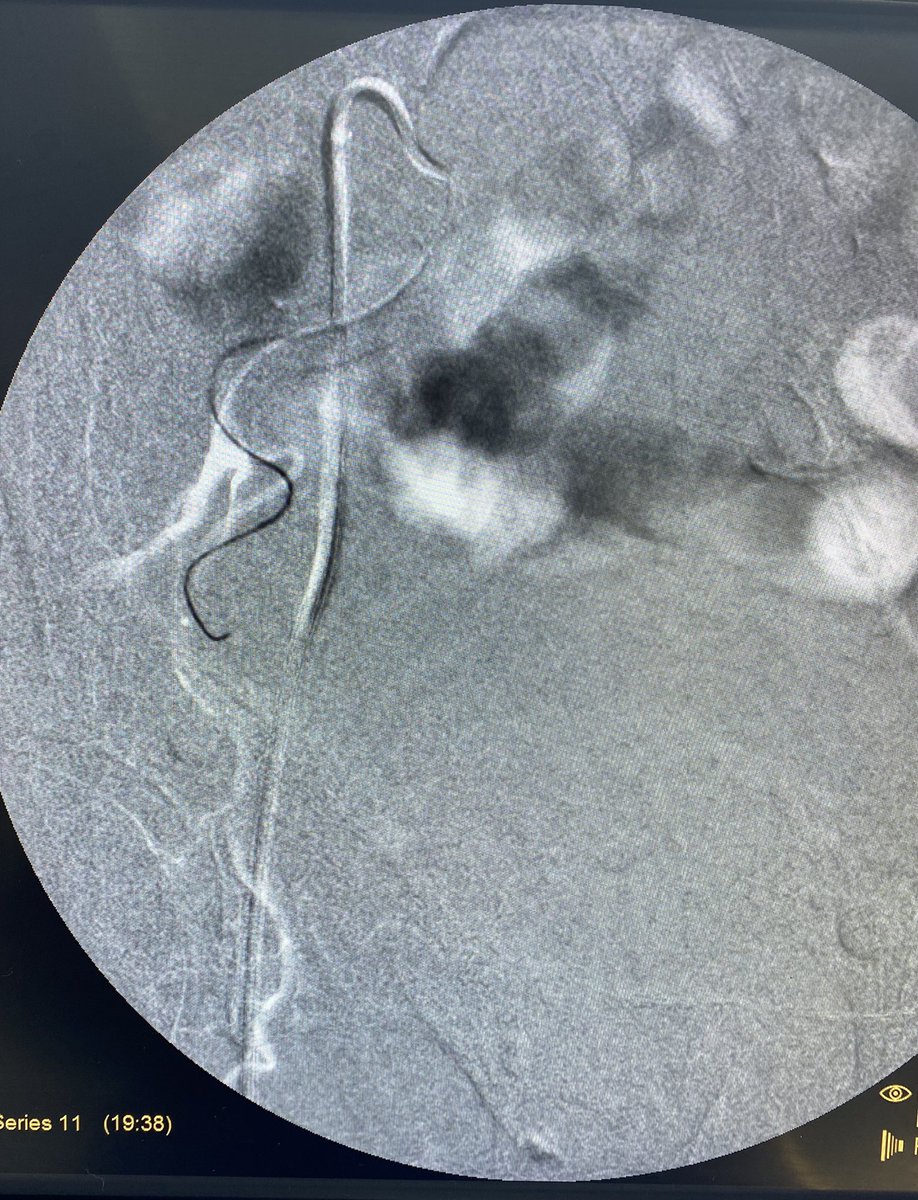 Sandeep Bagla MD tweet media