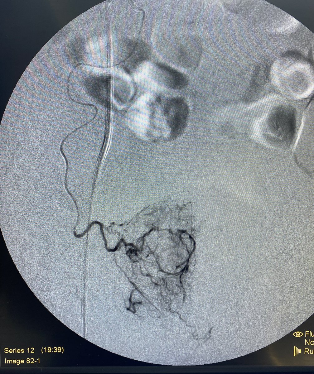 Sandeep Bagla MD tweet media