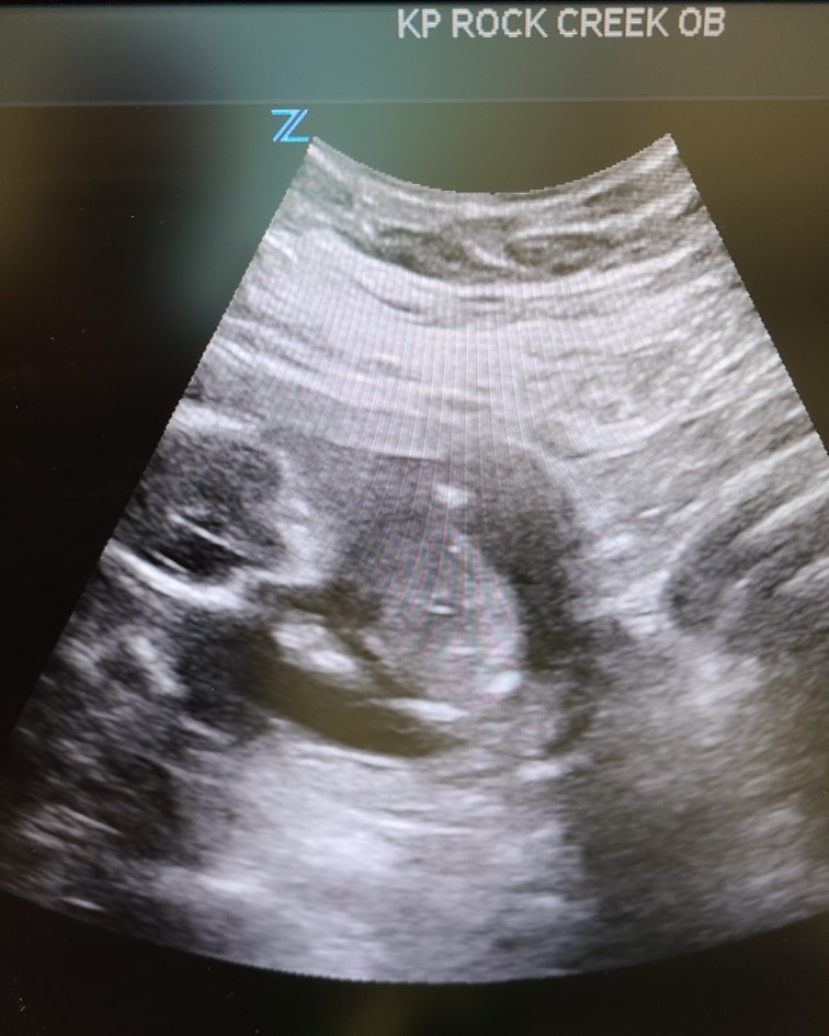 So I've held back a lot of info about this, but I guess it's pretty in cement right now. After 10 long years and 10 previous "misteps" my wife and I are going to be welcoming our first child into this world come 09/09/2021 if all things go as planned. Say hello to baby Ella Bise!