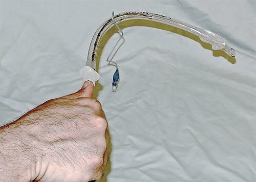 NaveenEipe's tweet image. Yes! ‘Single Operator #HAVL’

#ThumbsUp first, as soon as the glottis is approached, allows for 1-2in of stylet- free tube to pass thru VC.

Then #ThumbsDown, to advance the ET into trachea &amp;amp; remove stylet!
[Images- AIME airway &amp;amp; ACEP now]