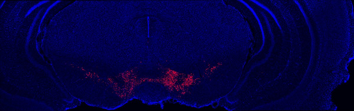 Not too shabby for a first attempt at IHC! Here are some beautiful dopamine neurons to brighten your Monday (sure brightened mine!)