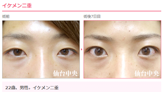 イケメン二重 Twitter Search Twitter イケメン二重 Twitter Search Twitter