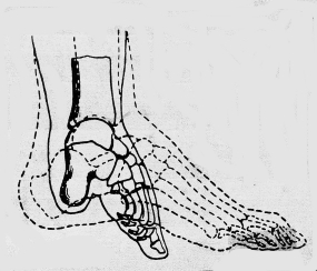 It has been estimated that by the 19th century, 40–50% of all Chinese women may have had bound feet, rising to almost 100% in upper-class Chinese women. Foot binding was a painful practice that significantly limited the mobility of women...